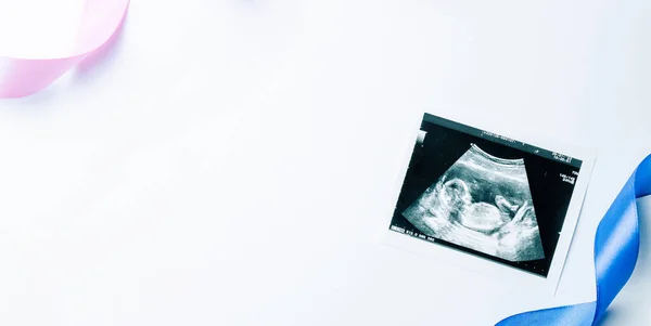 Ultrasound photo pregnancy baby. Blue, pink ribbon with ultrasound pregnancy picture on white background. Concept maternity, pregnancy, childbirth