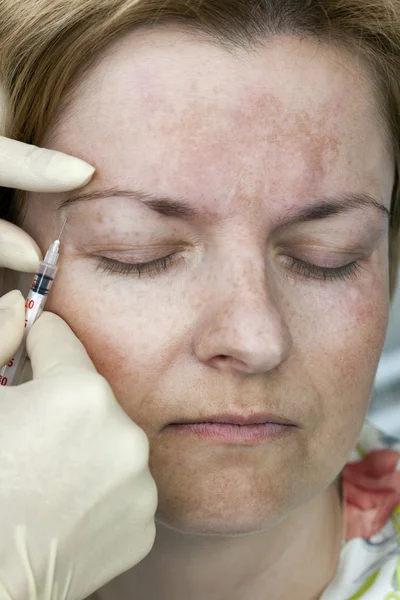 Botox injection — Stock Photo, Image