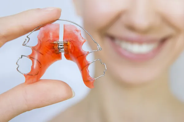 Chica sonriente sosteniendo aparatos ortopédicos para dientes — Foto de Stock