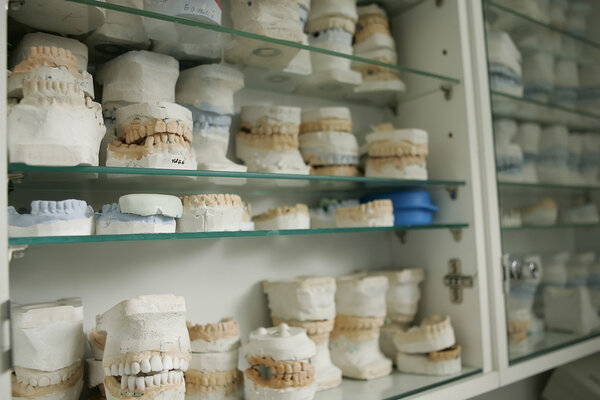 модели зубного гипса
