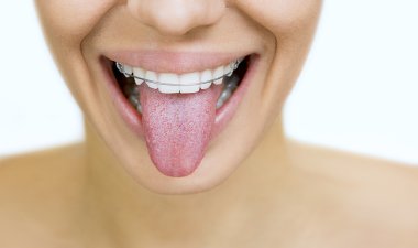 dilini yapışkanlık dışarı Diş telini kızla