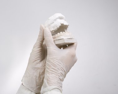 Dental Casting - hands holding dental gypsum models