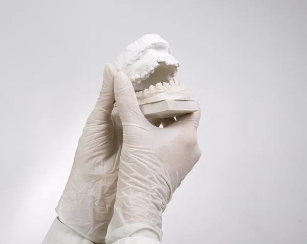 Dental gjutning - händer anläggning dental gips modeller — Stockfoto