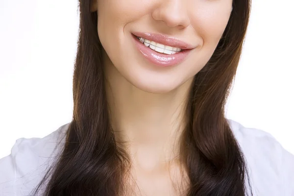 Menina sorridente bonita com retentor para dentes — Fotografia de Stock