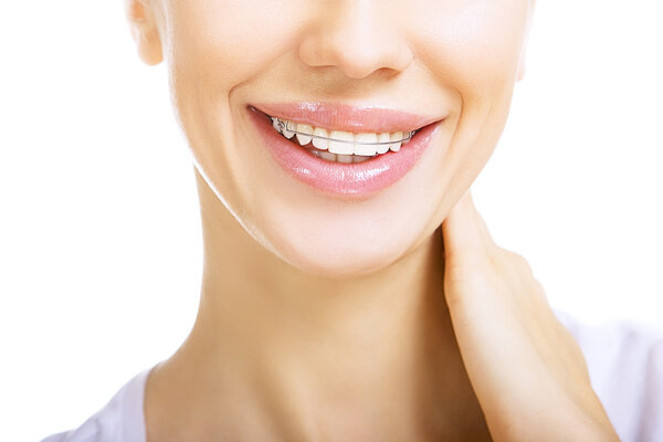 Beautiful smiling girl with retainer for teeth