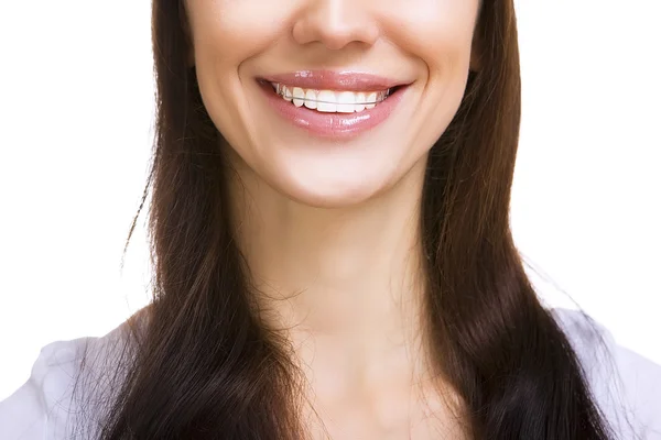 Menina sorridente bonita com retentor para dentes isolados — Fotografia de Stock