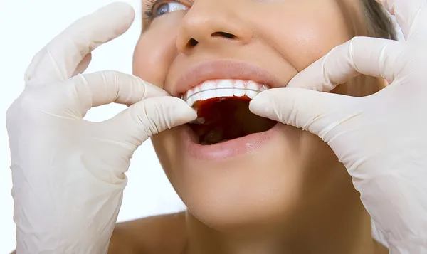 Orthodontic doctor examine teeth and gums of jaw, retainer for t — Stock Photo, Image