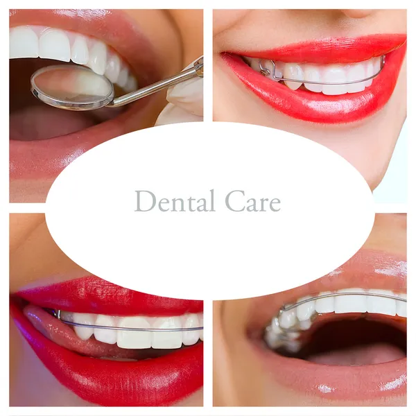 Dental care collage (dental services) — Stock Photo, Image