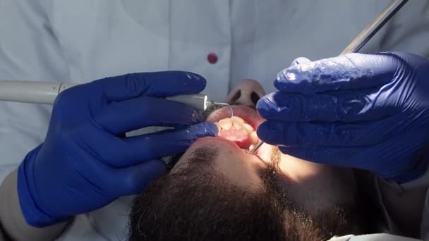 El dentista realiza la higiene bucal al paciente con ultrasonido. Limpieza de placa y sarro en una clínica dental. — Vídeo de stock