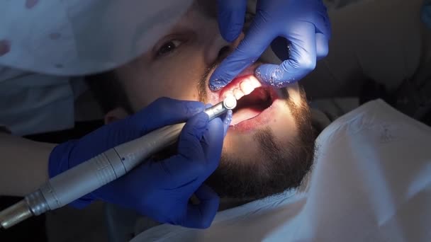 Mujer dentista profesional médico aplica una pasta especial a los dientes de un paciente en una clínica dental. Higiene de la cavidad oral. Limpieza profiláctica de dientes en clínica de estomatología. — Vídeo de stock