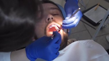 Dişçi diş tartarı ve bakterileri bulmak için erkek dişlerine mavi jel sürüyor. Ağız boşluğuna hijyen bakımı. Stomatoloji kliniğinde diş temizliği.