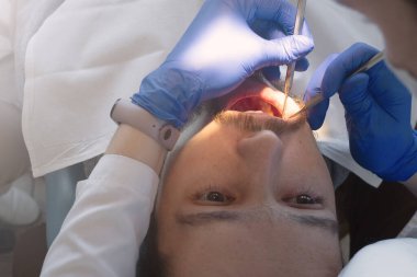 Dişçide muayene edilen bir adam. Diş kliniğinde plaket ve tartar temizliyorum. Koruyucu diş hijyeni ve kontrol.