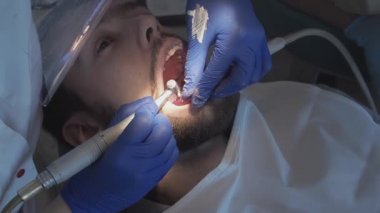 Profesyonel dişçi kadın diş hekimi, diş sağlığı kliniğindeki bir hastanın dişlerine özel bir macun sürer. Ağız boşluğuna hijyen bakımı. Stomatoloji kliniğinde diş temizliği.