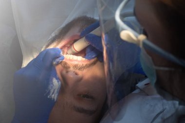 Diş hekimi ultrasonik diş temizliği yapıyor. Tartar ve plaketin çıkarılması. Diş hastalıklarının önlenmesi paradontit ve paradantoz