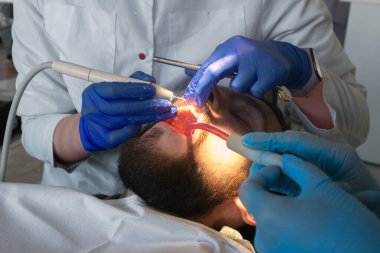 Diş hekimi ultrasonik diş temizliği yapıyor. Tartar ve plaketin çıkarılması. Diş hastalıklarının önlenmesi paradontit ve paradantoz