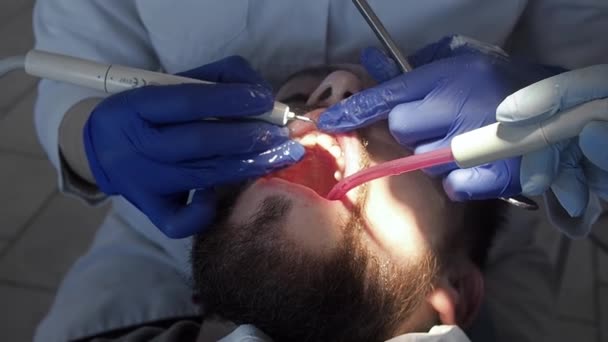 Der Zahnarzt führt die Mundhygiene des Patienten mit Ultraschall durch. Zahnbelag und Zahnstein in einer Zahnklinik reinigen. — Stockvideo