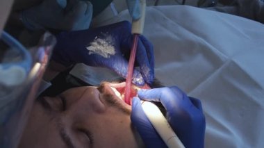 Diş hekimi ultrasonlu hastaya ağız temizliği yapar. Diş kliniğinde plaket ve tartar temizliği..