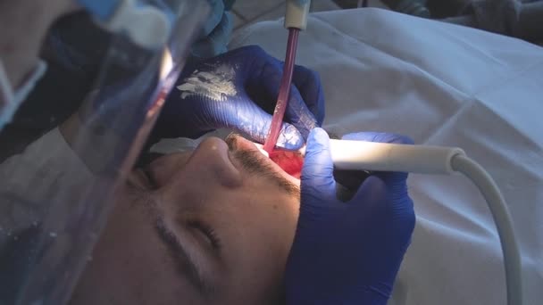 El dentista realiza la higiene bucal al paciente con ultrasonido. Limpieza de placa y sarro en una clínica dental. — Vídeo de stock