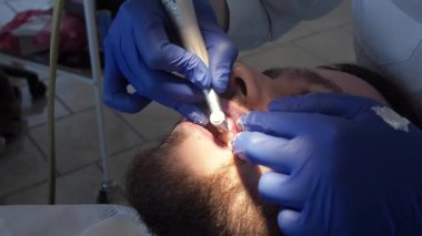 Profesyonel dişçi kadın diş hekimi, diş sağlığı kliniğindeki bir hastanın dişlerine özel bir macun sürer. Ağız boşluğuna hijyen bakımı. Stomatoloji kliniğinde diş temizliği.