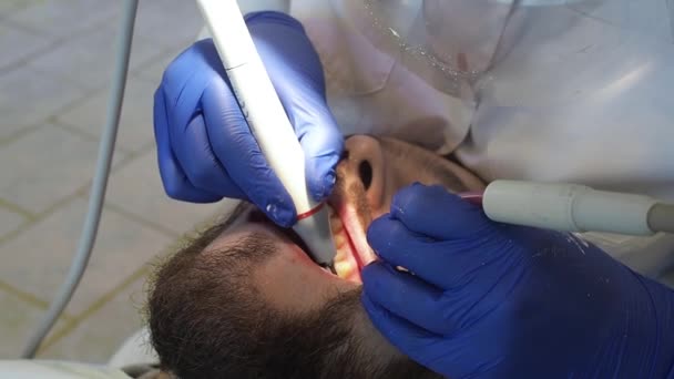 El dentista realiza la higiene bucal al paciente con ultrasonido. Limpieza de placa y sarro en una clínica dental. — Vídeo de stock