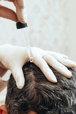 Bir kozmetolog yaşlanmayı önleyici prosedürler uygular, saç büyümesi için kafa derisine hyaluronik asit serumu uygular.