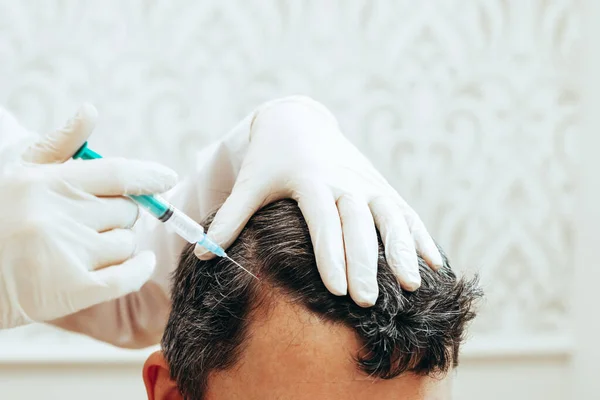 Cosmetologist performs anti-aging procedures injections hyaluronic acid into scalp, hair growth prevention hair loss man