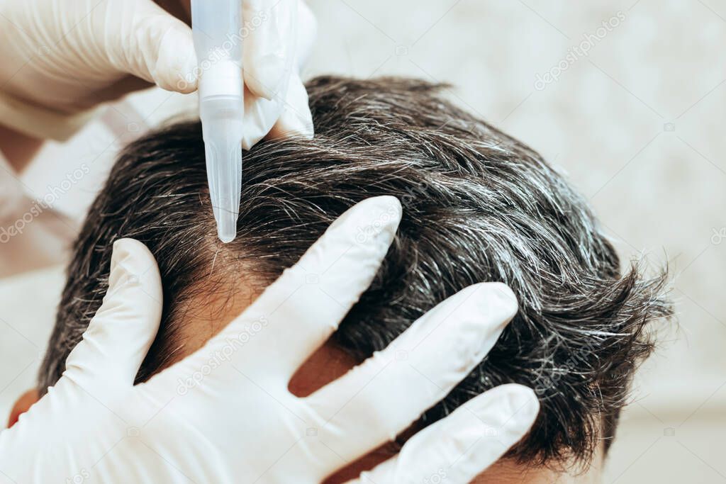 A cosmetologist performs anti-aging procedures, applies hyaluronic acid serum to the scalp, for hair growth and prevention of hair loss in a man