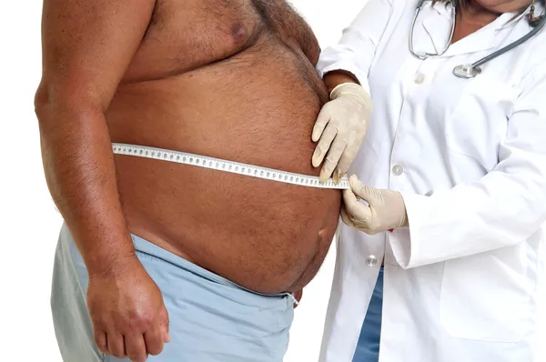 Mão de médico com paciente muito gordo do sexo masculino — Fotografia de Stock