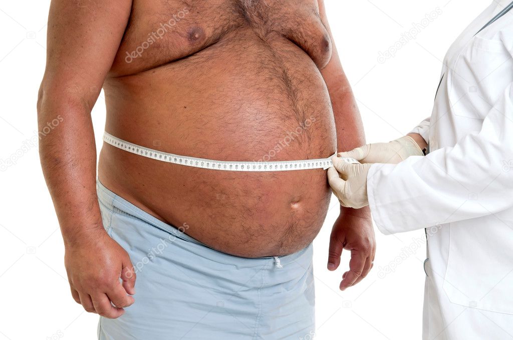 Large male patient belly with doctor