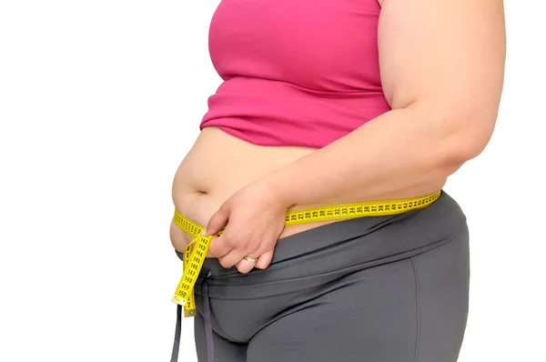 Obesity — Stock Photo, Image