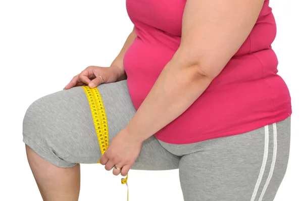 Obesity — Stock Photo, Image