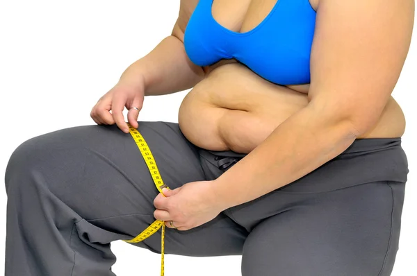 Obesity — Stock Photo, Image