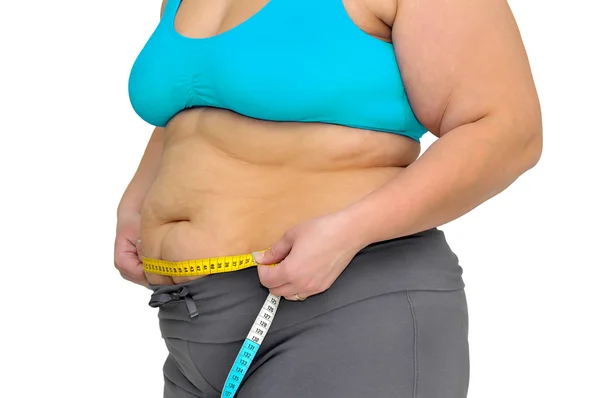 Obesity — Stock Photo, Image