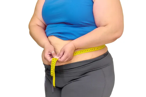 Obezite — Stok fotoğraf