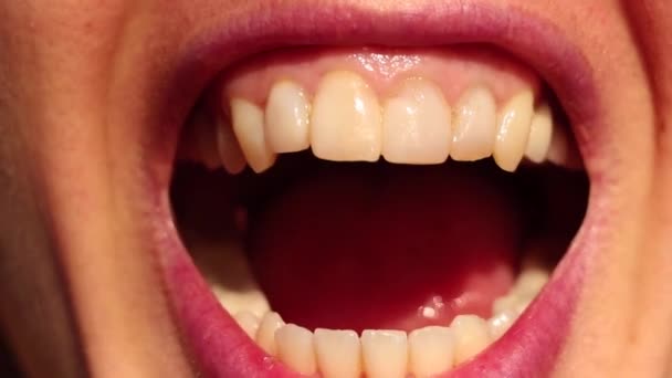 Boca aberta larga de uma jovem, dentes, boca aberta, lábios — Vídeo de Stock
