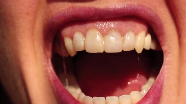 Широкий открытый рот молодой девушки, зубы, открытый рот, губы — стоковое видео