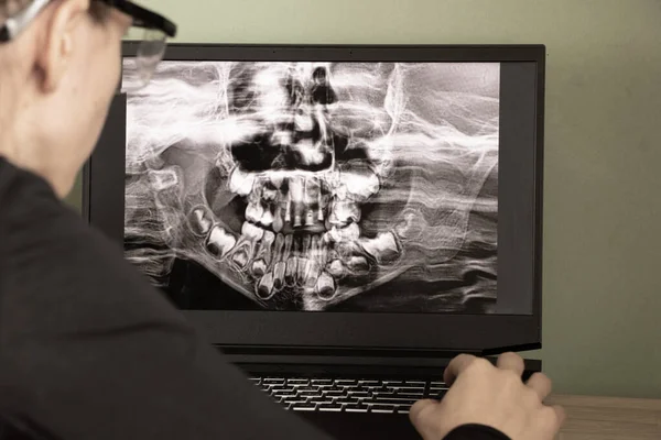 Radiografía Panorámica Los Dientes Los Niños Dos Mandíbulas Ortopantomograma Los — Foto de Stock