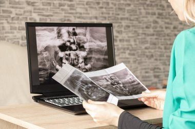 İki çenenin çocuk dişlerinin panoramik röntgeni, doktorun masasındaki dizüstü bilgisayarlarda çocukların dişlerinin ortomogramı, teşhis