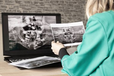 İki çenenin çocuk dişlerinin panoramik röntgeni, doktorun masasındaki dizüstü bilgisayarlarda çocukların dişlerinin ortomogramı, teşhis