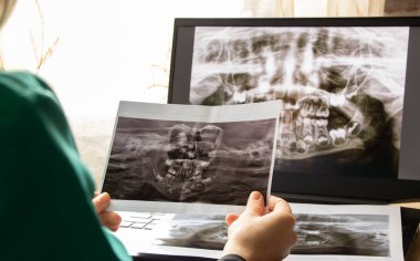 İki çenenin çocuk dişlerinin panoramik röntgeni, doktorun masasındaki dizüstü bilgisayarlarda çocukların dişlerinin ortomogramı, teşhis