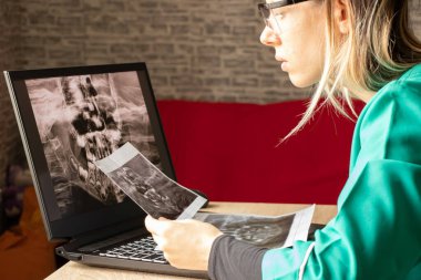 İki çenenin çocuk dişlerinin panoramik röntgeni, doktorun masasındaki dizüstü bilgisayarlarda çocukların dişlerinin ortomogramı, teşhis