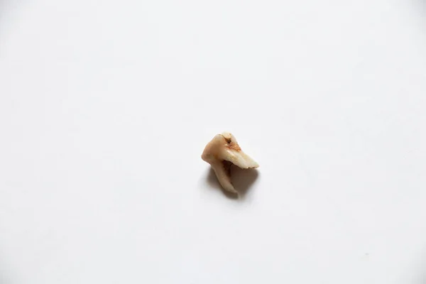 Молочный Зуб Вырвал Ложь Белом Фоне Стоматология Зубы — стоковое фото
