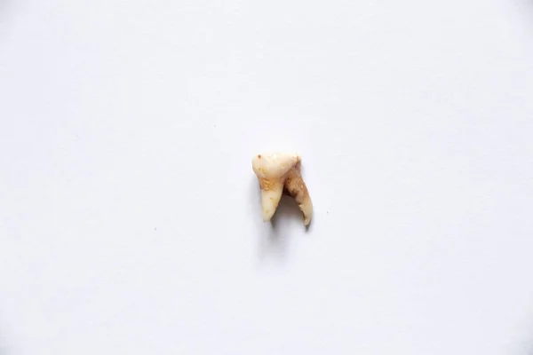 Молочный Зуб Вырвал Ложь Белом Фоне Стоматология Зубы — стоковое фото