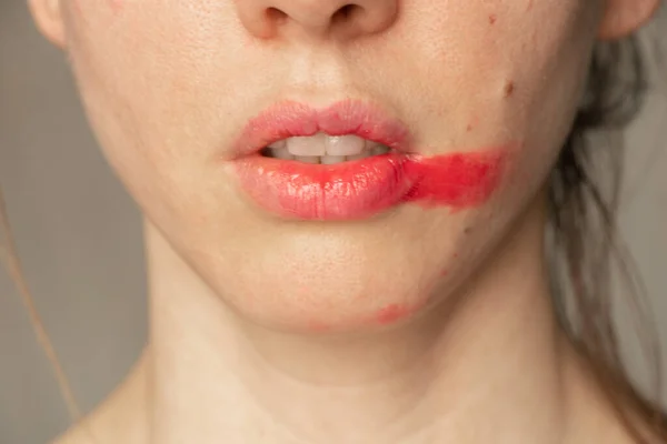 Young Girl Red Lipstick Her Lips Treatment Lips — Stockfoto