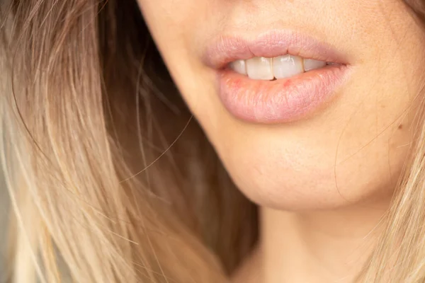 Lippen Eines Jungen Mädchens Ohne Behandlung Lippen Und Mund Gesicht — Stockfoto