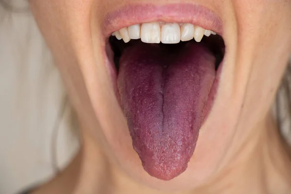 Red Tongue Mulberry Open Mouth Tongue Girl Close — Stockfoto