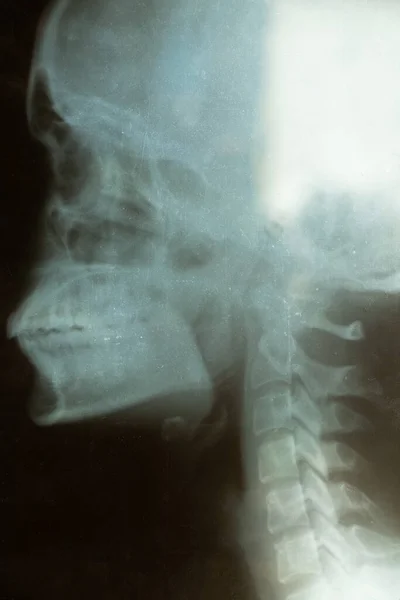 Old Ray Female Skull Close Examination Skull Diagnosis — Stockfoto