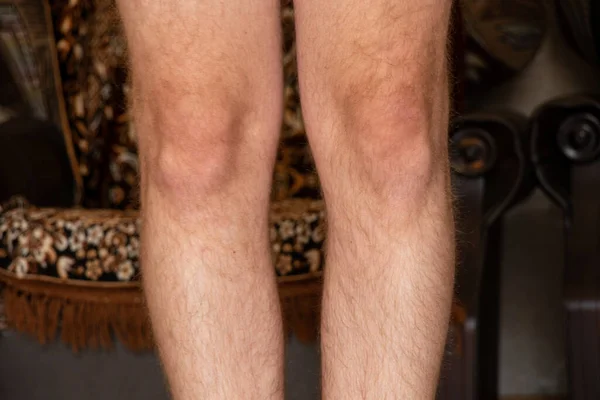 Men's legs are hairy and kneecap at home,part of the body ,leg of a young and healthy man