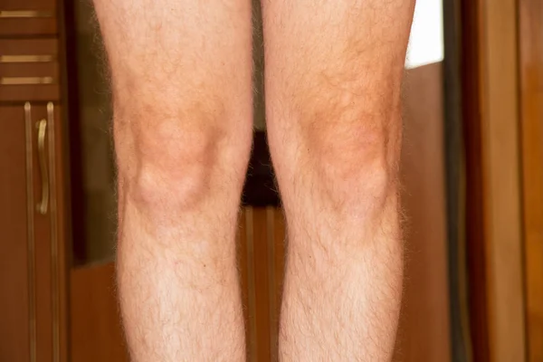 Men's legs are hairy and kneecap at home,part of the body ,leg of a young and healthy man
