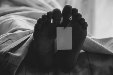 Women's legs with a tag covered with a sheet on the table, the legs of a deceased person, the sale of dead people